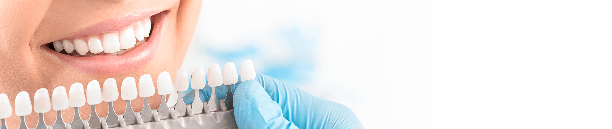 Veneers in Fresno, California